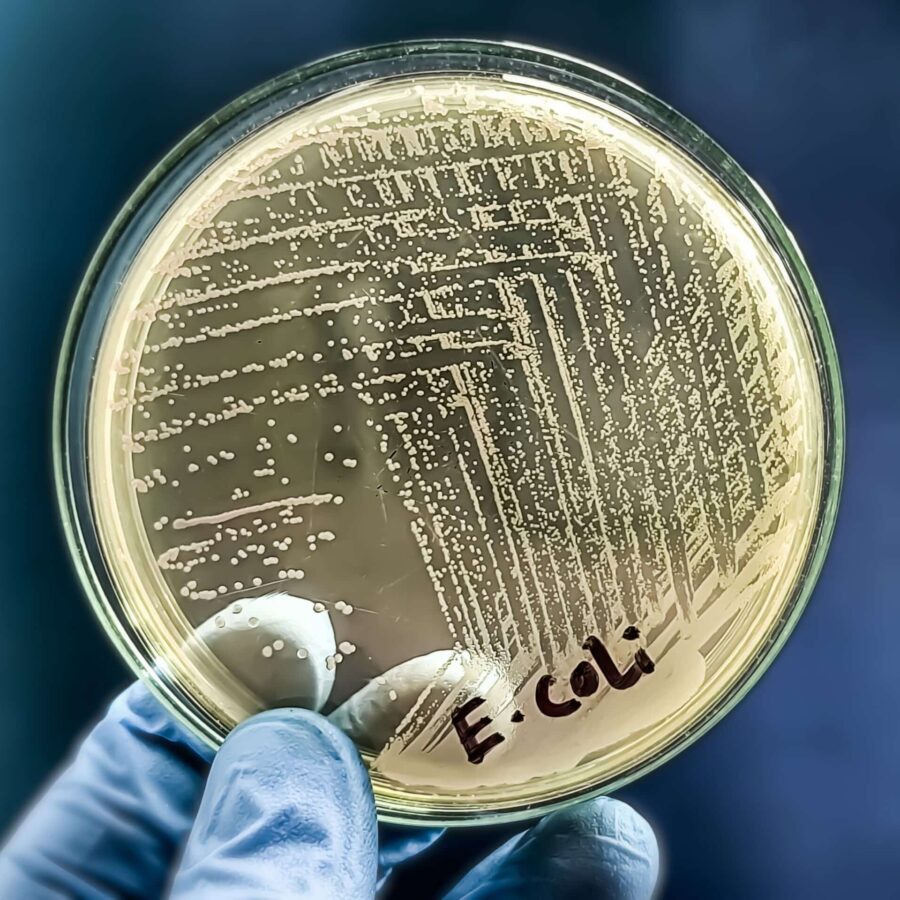 E. Coli Petri Dish