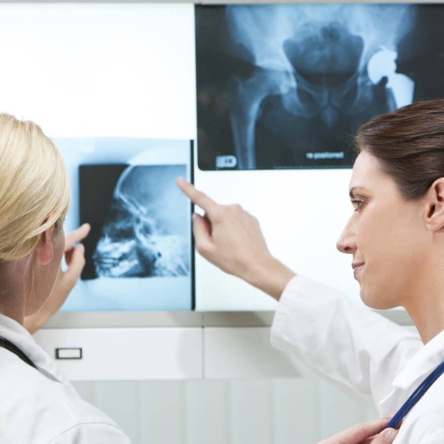 Doctors Reviewing X-Rays