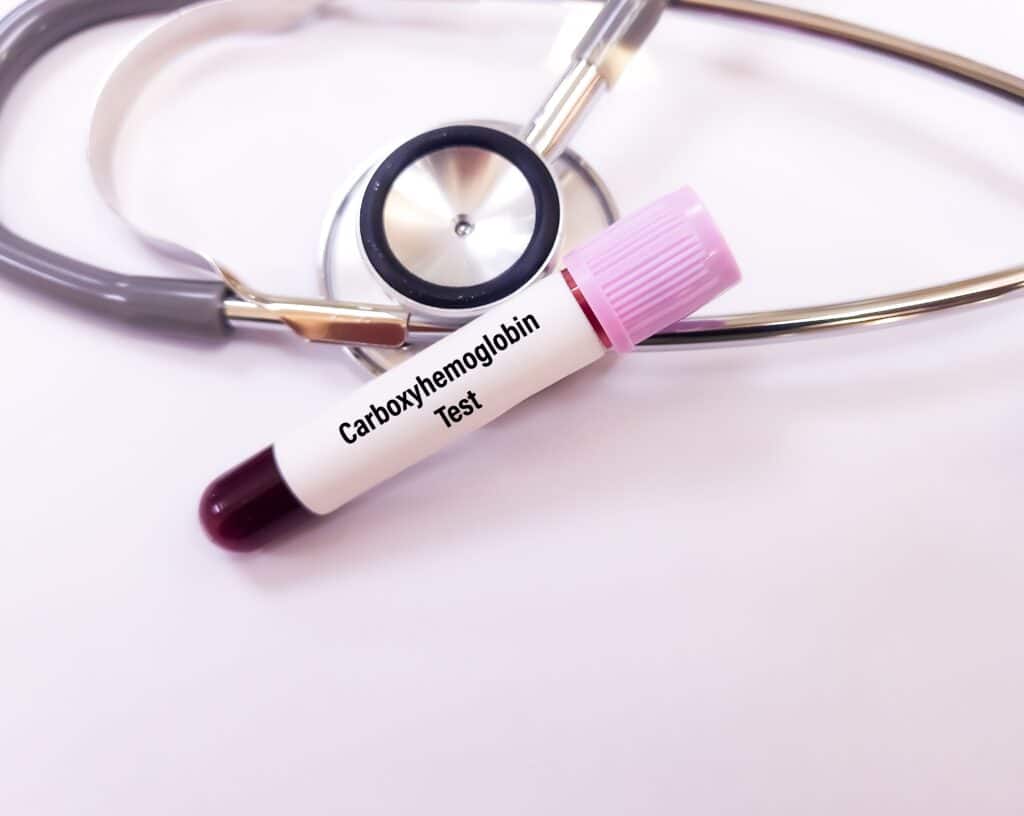 What Are The Symptoms Of Carbon Monoxide Poisoning? 1 Carbon Monoxide Blood Test