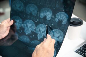 Brain Scan